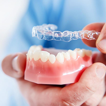 Invisalign Aligners in Vijayawada