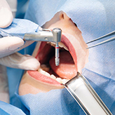 Minimally invasive oral surgical procedures